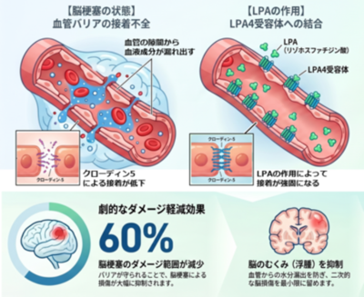 脂質メディエーターLPAが脳梗塞のダメージを軽減