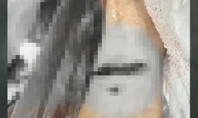 夜間に住宅街で暴行、70代女性投げ飛ばされ負傷…韓国・被害女性「今も震える」