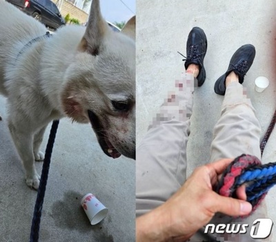 突進してきた首輪のない犬、珍島犬とその飼い主が噛まれ、血まみれ…「これは殺人未遂」