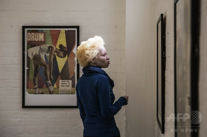 アルビノへの偏見乗り越えモデルに、南アのタンド・ホパさん