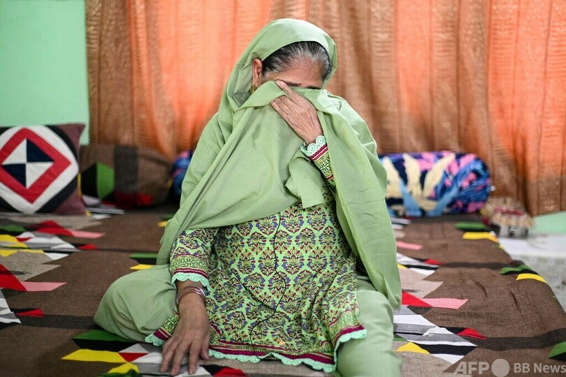 植毛手術後に死亡、YouTubeで独学の素人施術が横行 インド