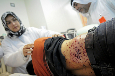 バーレーンの反体制デモ激化、治安部隊発砲で200人負傷