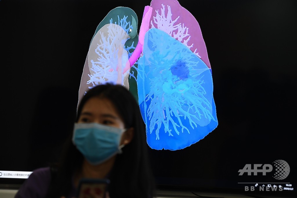 世界初、新型ウイルス患者の肺移植手術に成功 中国・無錫 世界初、新型ウイルス患者の肺移植手術に成功 中国・無錫