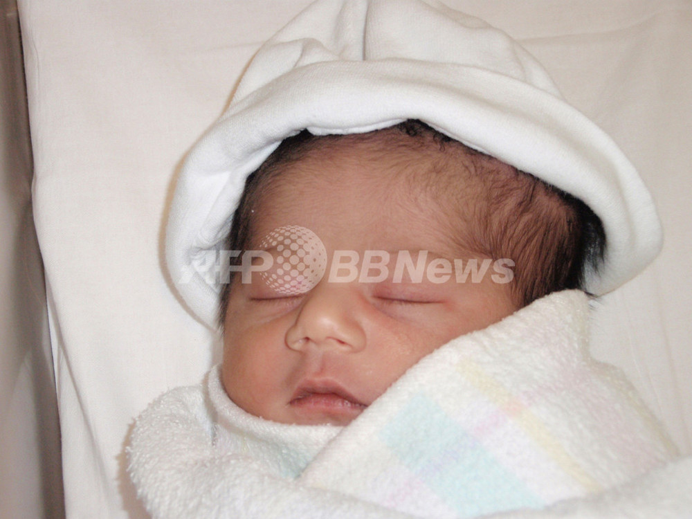 オーストラリアで奇跡の赤ちゃん誕生 臨月まで卵巣で無事育つ 写真3枚 国際ニュース Afpbb News