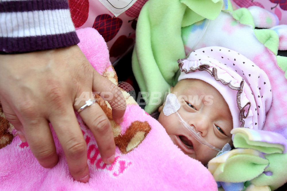 270グラムで生まれた赤ちゃんが退院、米国 写真5枚 国際ニュース
