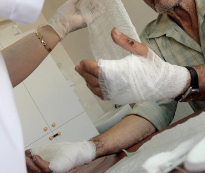 夜間の傷は治りが遅い、体内時計に関連か 英研究