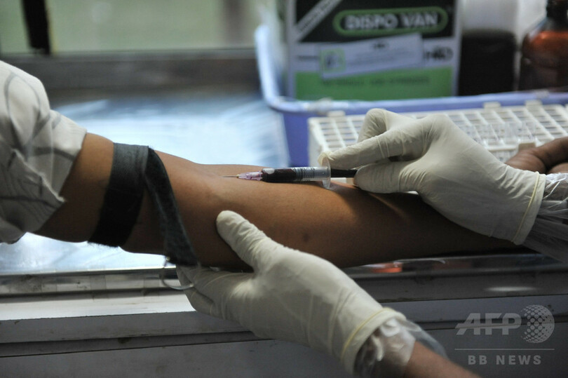 欧州のHIV感染者、7人に1人が「無自覚」
