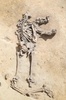 仏東部のアルザス地方で見つかった人骨。負傷の痕が確認できる（2016年6月7日提供）。(c)AFP/INRAP / Michel Christen