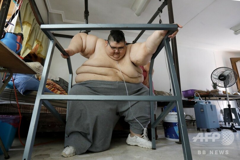 世界で最も重かった男性、コロナを克服 減量治療のおかげ？