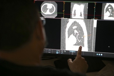 Xマス祝賀の代わりにがん宣告 英診療所、患者に誤送信