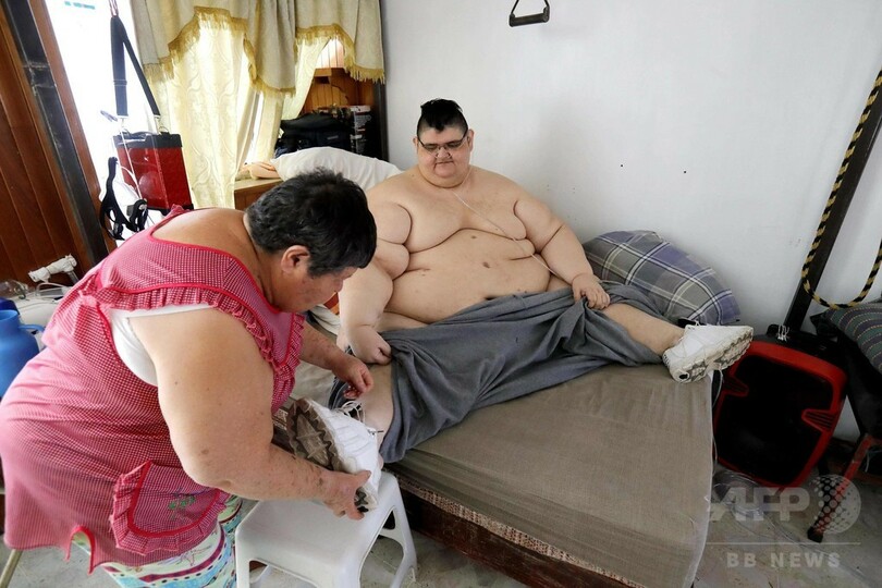 世界で最も重かった男性、250キロ減量 再び歩けることを夢見て