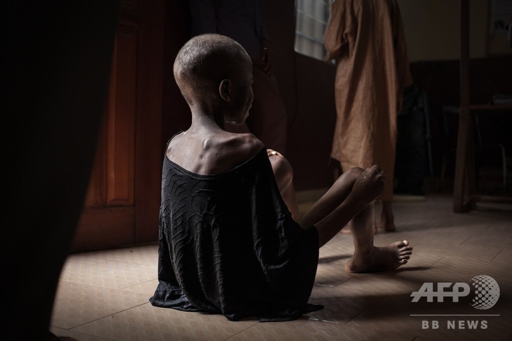 中央アフリカの飢える子どもたち、暴力と貧困が引き起こす飢餓危機 写真17枚 国際ニュース：AFPBB News