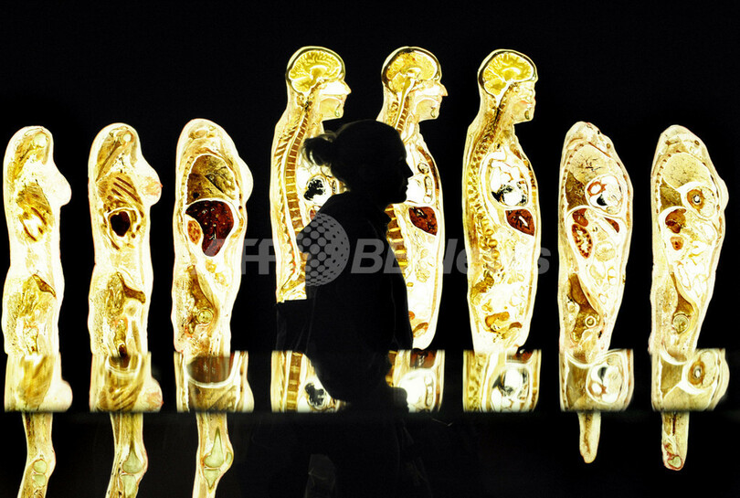 「人体の世界」展、ベルリンで開幕