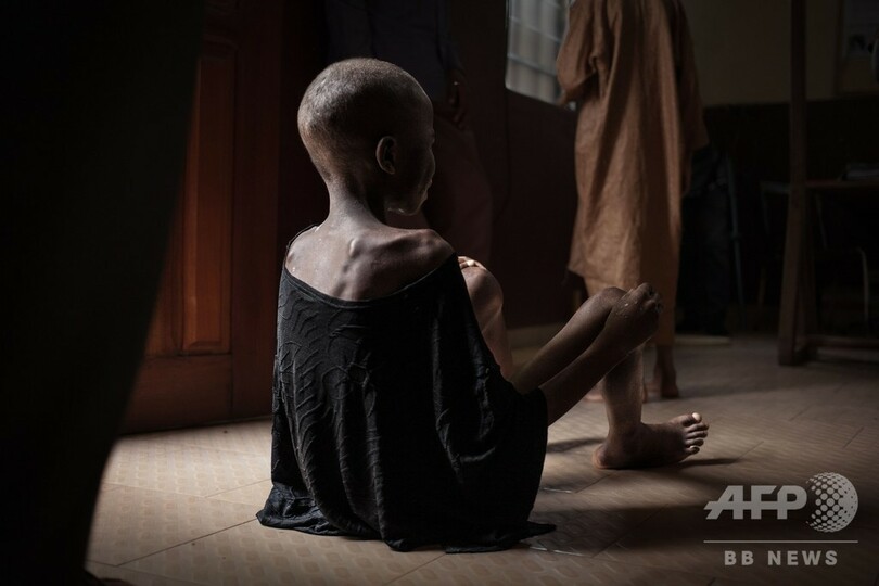 中央アフリカの飢える子どもたち 暴力と貧困が引き起こす飢餓危機 写真17枚 国際ニュース Afpbb News