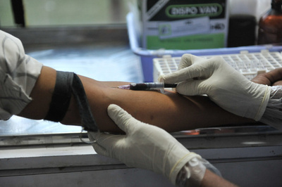 欧州のHIV感染者、7人に1人が「無自覚」