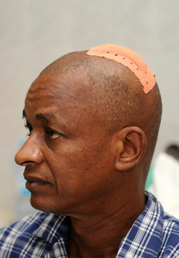 ギニア、軍による新たな発砲で3人が死亡 負傷者の拉致も