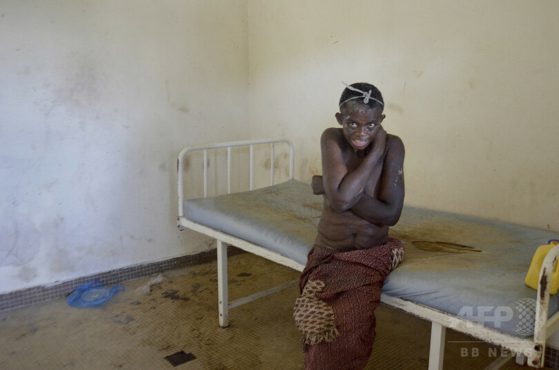 ガボン唯一の精神科病院、患者を「動物扱い」