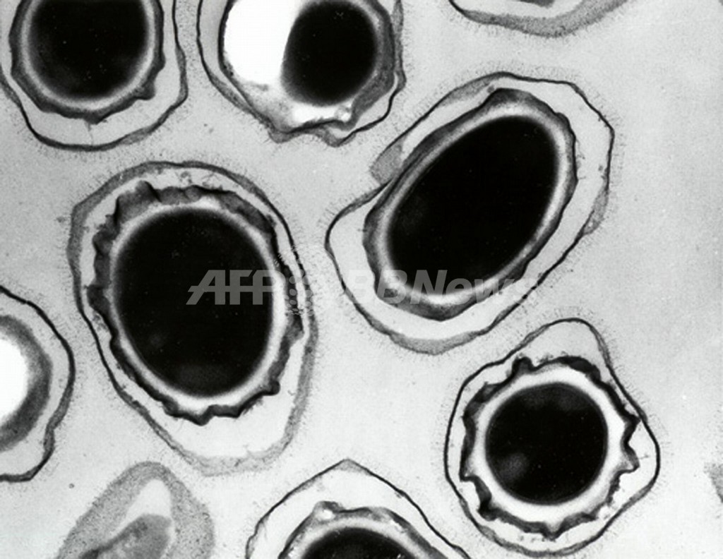カナダが大戦中に炭疽菌爆弾を製造、ドキュメンタリー番組で明らかに カナダが大戦中に炭疽菌爆弾を製造、ドキュメンタリー番組で明らかに