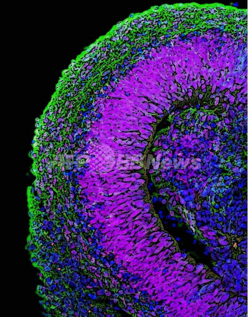 幹細胞を使った臨床試験、英国で開始へ 脳卒中と失明の患者を対象に