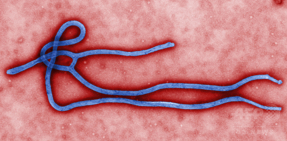 かわいい エボラウイルスのぬいぐるみが人気 写真1枚 国際ニュース Afpbb News