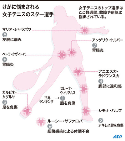 女子テニス選手の故障者が続出、全豪オープンに懸念の声