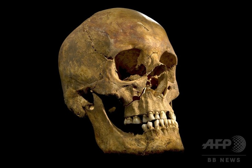 リチャード3世の「凄惨な死」、遺骨から明らかに