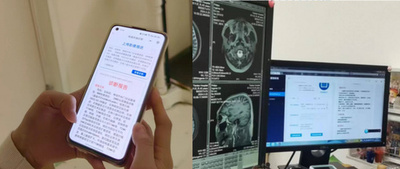 1秒もかからず正確に診断 なんと人間ではない「神医」 中国