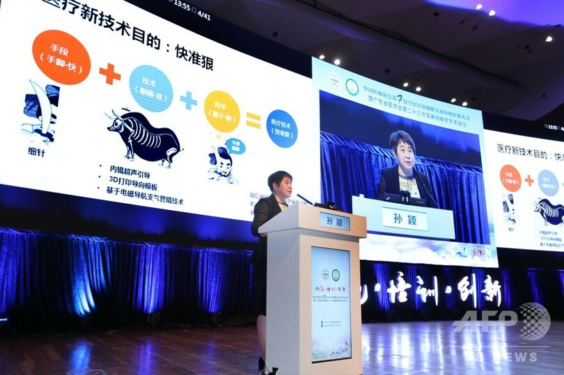 消化系統の腫瘍AI診断システムを開発、中国の研究チーム