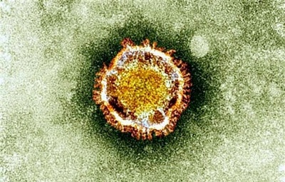中東呼吸器症候群、サウジで新たに1人死亡 世界全体の死者31人に