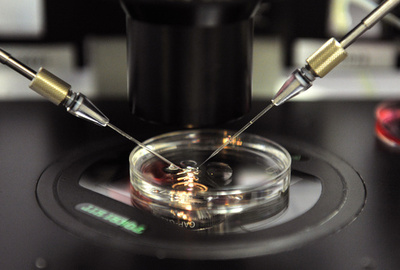 ヒト精子を皮膚細胞から作製、スペイン研究