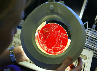 薬剤耐性菌のまん延で世界経済危機の恐れ 世界銀行