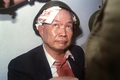 殴りかかられ応急処置を受けた旧ポル・ポト（Pol Pot）政権のキュー・サムファン（Khieu Samphan）幹部会議長（1991年11月27日撮影）。(c)AFP/STEFAN ELLIS