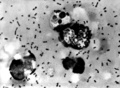 患者から採取された腺ペスト菌の画像（2003年1月15日提供、資料写真）。(c)AFP/CDC
