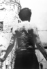 原子爆弾が投下された後、被爆によるやけどの治療のため6年間入院していた広島市内の病院を退院する男性（1951年8月撮影）。(c)AFP