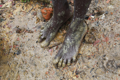 【AFP記者コラム】ロヒンギャ取材で刻まれた傷（パート1）─子どもたちの惨状、心えぐられる思い