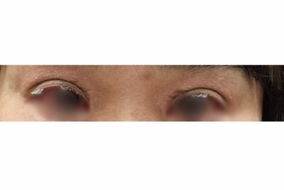 韓国の美容院、「まつげパーマ」客の毛が「丸ごと抜ける」恐怖…誤って接着剤使用