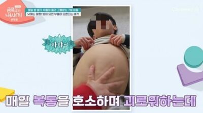 「血管が見えるほどお腹が膨らむ韓国の7歳」…専門家が特定した「その原因」