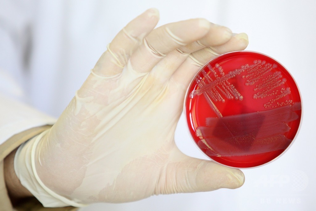 大腸菌と糖からプロパン、将来の持続可能エネルギーに期待 研究 大腸菌と糖からプロパン、将来の持続可能エネルギーに期待 研究