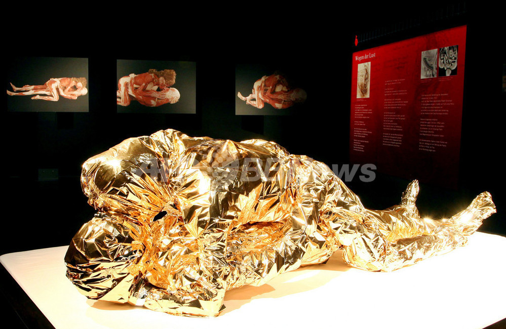 「愛の営み」に待った！行政命令で人体標本にカバー ドイツ 写真2枚 国際ニュース：AFPBB News