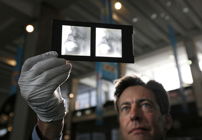 現代科学技術で最も偉大な功績は「レントゲン」、英アンケート結果