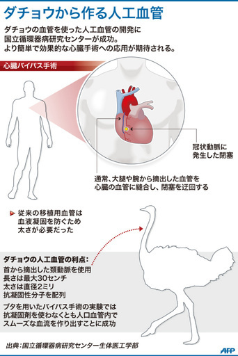 ダチョウから人工血管、国循が開発 心臓バイパスに期待