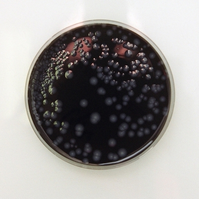 英エディンバラのレジオネラ菌感染、死者2人に