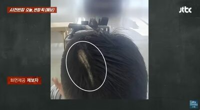 髪を切ったら“5センチの溝”が…韓国・美容室、女性の頭部に「バリカン跡」の悲劇