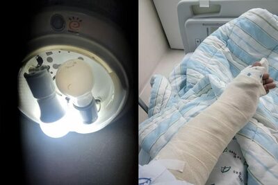 韓国のエレベーター、電灯が割れ、腕が傷つき、長期リハビリ…対応避けるマンションに非難集中