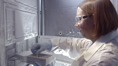 HIVの新種亜型を特定 19年ぶり 米研究