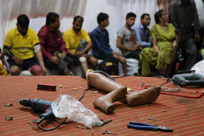 切断した患者の脚を枕代わりに… 医師2人停職処分、インド