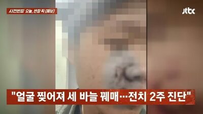 暴行止めた市民、「児童虐待」で逆告訴される…韓国・殴られ2週間のけが、それでも親が通報