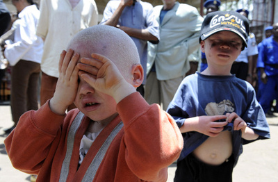 アルビノ男性殺人事件、カトリック司祭に禁錮30年 マラウイ