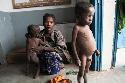 「飢餓で膨れるお腹」