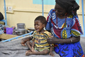 ニジェールのジンデルに設置されたスイスのNGO「サンティネル」の診療所で、壊疽性口内炎（水がん）の治療を受ける子ども（2015年5月26日撮影）。(c)AFP/ISSOUF SANOGO